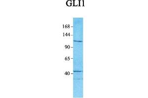 Host:  Rabbit  Target Name:  GLI1  Sample Tissue:  Human Jurkat  Antibody Dilution:  1. (GLI1 anticorps  (C-Term))