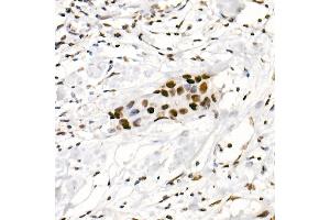 Immunohistochemistry of paraffin-embedded human placenta using DDX3X Rabbit pAb (ABIN6130252, ABIN6139494, ABIN6139495 and ABIN6221274) at dilution of 1:100 (40x lens). (DDX3X anticorps  (AA 1-220))