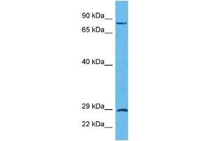 Host:  Rabbit  Target Name:  TRIM32  Sample Tissue:  Human HCT116 Whole Cell  Antibody Dilution:  1ug/ml (TRIM32 anticorps  (C-Term))
