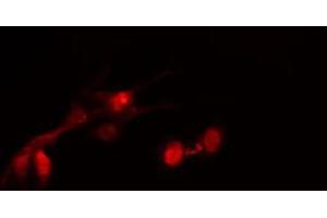 ABIN6267679 staining HeLa cells by IF/ICC. (HDAC2 anticorps  (pSer394))