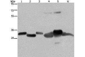 Western Blot analysis of Mouse thymus and Human ovarian cancer tissue, Mouse heart, Human fetal liver, Mouse liver tissue and SKOV3 cell using HMGCL Polyclonal Antibody at dilution of 1:300 (HMGCL anticorps)