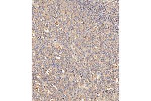 Immunohistochemical analysis of paraffin-embedded human appendix tissue using (ABIN1882197 and ABIN2843885) performed on the Leica® BOND RXm.