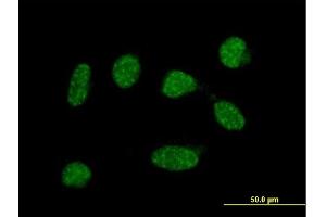Immunofluorescence of  purified  MaxPab antibody to C19orf50 on HeLa cell. (C19orf50 anticorps  (AA 1-176))