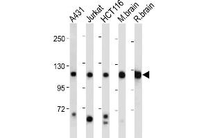 All lanes : Anti-PI3KCA Antibody (Center) at 1:2000 dilution Lane 1: A431 whole cell lysate Lane 2: Jurkat whole cell lysate Lane 3: HC whole cell lysate Lane 4: Mouse brain tissue lysate Lane 5: Rat brain tissue lysate Lysates/proteins at 20 μg per lane. (PIK3CA anticorps  (AA 504-533))