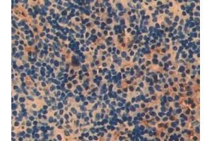 Detection of PARP in Mouse Spleen Tissue using Polyclonal Antibody to Poly ADP Ribose Polymerase (PARP)