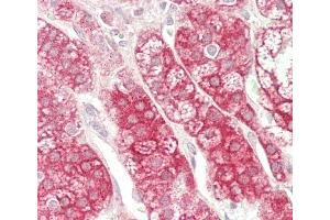 Formalin-fixed and paraffin-embedded H.