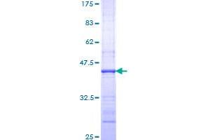 Image no. 1 for Polymeric Immunoglobulin Receptor (PIGR) (AA 21-130) protein (GST tag) (ABIN1315036)