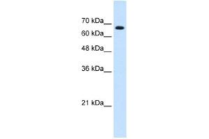 WB Suggested Anti-ZNF564 Antibody Titration:  0. (ZNF564 anticorps  (C-Term))