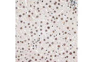 Immunohistochemistry of paraffin-embedded rat liver using CBX6 antibody (ABIN6127558, ABIN6138026, ABIN6138027 and ABIN6221185) at dilution of 1:100 (40x lens). (CBX6 anticorps  (AA 80-180))