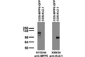 Transfected cell immunoblot: extracts of COS cells transfected with GFP-tagged MPP8 and untagged Kv2.