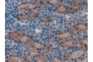 Detection of HGD in Mouse Kidney Tissue using Polyclonal Antibody to Homogentisate-1,2-Dioxygenase (HGD)