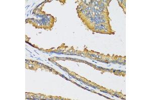 Immunohistochemistry of paraffin-embedded human prostate using CXCL11 antibody (ABIN6130151, ABIN6139269, ABIN6139270 and ABIN6221788) at dilution of 1:100 (40x lens). (CXCL11 anticorps  (AA 22-94))