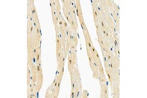 Immunohistochemistry of paraffin embedded mouse heart using COPS2 (ABIN7073324) at dilution of 1:1400 (400x lens) (CSN2 anticorps)