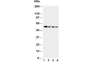 Western blot testing of Caspase-10 antibody and Lane 1:  COLO320;  2: HeLa;  3: SW620;  4: Raji cell lysate (Caspase 10 anticorps  (AA 220-236))