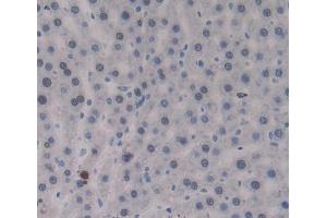 Used in DAB staining on fromalin fixed paraffin- embedded Kidney tissue