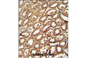 DEGS2 antibody (C-term) (ABIN654539 and ABIN2844256) immunohistochemistry analysis in formalin fixed and paraffin embedded human kidney tissue followed by peroxidase conjugation of the secondary antibody and DAB staining. (DEGS2 anticorps  (C-Term))