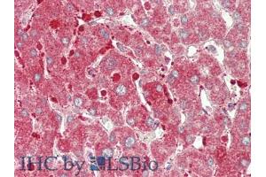 IHC-P analysis of Human Liver Tissue, with HE staining. (CPT1A anticorps  (AA 191-353))