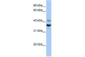 WB Suggested Anti-NEUROD1 Antibody Titration:  0. (NEUROD1 anticorps  (Middle Region))