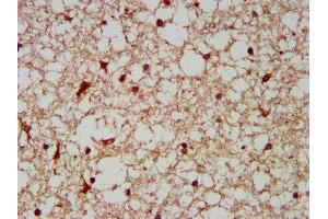IHC image of ABIN7142166 diluted at 1:200 and staining in paraffin-embedded human brain tissue performed on a Leica BondTM system. (BCKDHA anticorps  (AA 268-407))