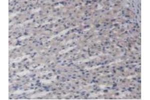 Detection of AGXT2 in Rat Stomach Tissue using Polyclonal Antibody to Alanine Glyoxylate Aminotransferase 2 (AGXT2)