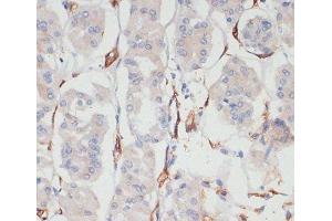 Immunohistochemistry of paraffin-embedded Human stomach using CD36 Polyclonal Antibody at dilution of 1:200 (40x lens). (CD36 anticorps)
