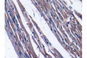 DAB staining on IHC-P; Samples: Rat Cardiac Muscle Tissue