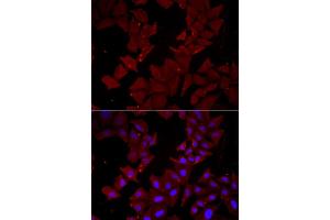 Immunofluorescence analysis of HeLa cell using CCT4 antibody. (CCT4 anticorps)