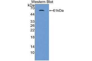 Western Blotting (WB) image for anti-Nuclear Receptor Subfamily 3, Group C, Member 2 (NR3C2) (AA 739-984) antibody (ABIN1859878) (NR3C2 anticorps  (AA 739-984))