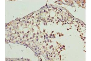 Immunohistochemistry of paraffin-embedded human testis tissue using ABIN7160978 at dilution of 1:100 (CYB5R2 anticorps  (AA 1-237))