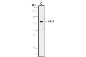 Image no. 1 for anti-Interleukin 23 Receptor (IL23R) (AA 24-354) antibody (ABIN204348) (IL23R anticorps  (AA 24-354))