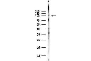anti-Dual-Specificity tyrosine-(Y)-phosphorylation Regulated Kinase 1A (DYRK1A) (pTyr449) antibody