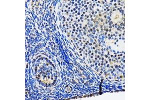 Immunohistochemistry of paraffin-embedded rat ovary using TP53 antibody.