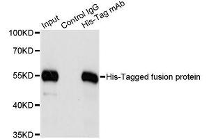 Immunoprecipitation of over-expressed His-tagged protein in 293T cells incubated using His-tag antibody. (His Tag anticorps)