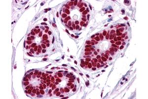 Anti-TRIM28 antibody IHC of human breast. (KAP1 anticorps  (AA 823-835))