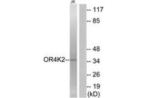 Western blot analysis of extracts from Jurkat cells, using OR4K2 Antibody. (OR4K2 anticorps  (AA 265-314))