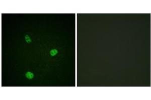 Immunofluorescence analysis of HeLa cells, using MITF (epitope around residue 180/73) antibody. (MITF anticorps  (Ser73, Ser180))