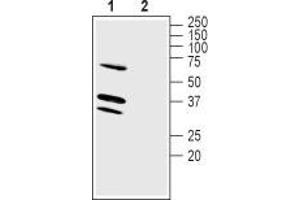 Western blot analysis of mouse brain membranes: - 1. (LRRC26 anticorps  (Intracellular))