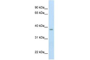 Western Blot showing ZMYND11 antibody used at a concentration of 1-2 ug/ml to detect its target protein.