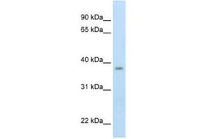 Western Blot showing ZMYND11 antibody used at a concentration of 1-2 ug/ml to detect its target protein. (ZMYND11 anticorps  (Middle Region))