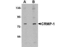 Western blot analysis of CRMP1 in rat brain tissue lysate with AP30244PU-N CRMP1 antibody at (A) 1 and (B) 2 μg/ml. (CRMP1 anticorps  (N-Term))