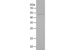 Western Blotting (WB) image for Meteorin, Glial Cell Differentiation Regulator-Like (METRNL) (AA 46-311) protein (His-IF2DI Tag) (ABIN7123929)