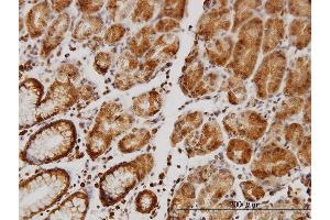 Immunoperoxidase of monoclonal antibody to SLC9A1 on formalin-fixed paraffin-embedded human stomach.