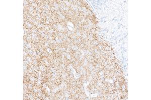 Immunohistochemistry (IHC) image for anti-Tyrosine Hydroxylase (TH) (AA 450-500) antibody (ABIN7449433) (Recombinant Tyrosine Hydroxylase anticorps  (AA 450-500))