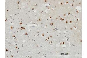 Image no. 1 for anti-Fibroblast Growth Factor 12 (FGF12) (AA 1-182) antibody (ABIN598680) (FGF12 anticorps  (AA 1-182))