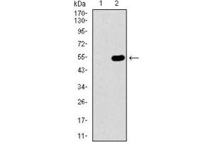 Western Blotting (WB) image for anti-Wolf-Hirschhorn Syndrome Candidate 2 (WHSC2) (AA 280-511) antibody (ABIN1846367)
