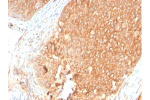 Formalin-fixed, paraffin-embedded human Pancreas stained with Topo I Rabbit Recombinant Monoclonal Antibody (TOP1MT/2883R).