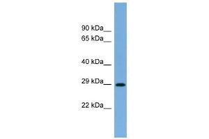 RAB40C antibody used at 1 ug/ml to detect target protein. (RAB40C anticorps  (N-Term))