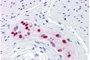 Human Colon, myenteric plexus: Formalin-Fixed, Paraffin-Embedded (FFPE)