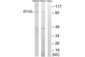 Western blot analysis of extracts from HeLa cells and HepG2 cells, using IFI16 antibody. (IFI16 anticorps)