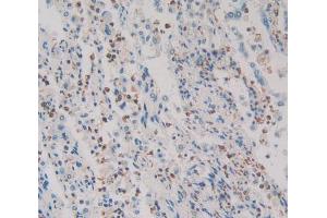 Used in DAB staining on fromalin fixed paraffin- embedded lung cancer tissue (HMGXB4 anticorps  (AA 264-540))